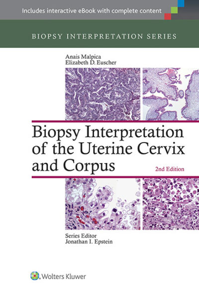Biopsy Interpretation of the Uterine Cervix and Corpus (Biopsy Interpretation Series) 2/E 2015