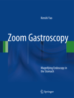 Zoom Gastroscopy: Magnifying Endoscopy in the Stomach  2014