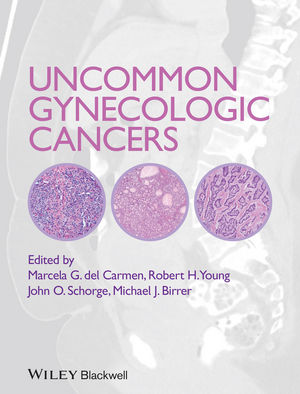 Uncommon Gynecologic Cancers 2015