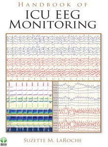 Handbook of ICU EEG Monitoring 2013