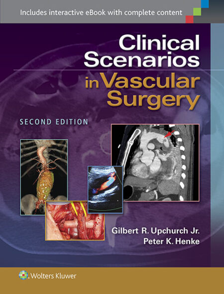 Clinical Scenarios in Vascular Surgery 2/E 2015