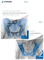 Fractures of the Pelvis and Acetabulum :Principles and Methods of Management  2Vols