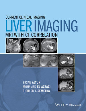 Liver Imaging: MRI with CT Correlation (Current Clinical Imaging) 2015