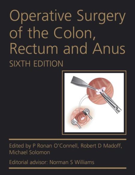 Operative Surgery of the Colon, Rectum and Anus, 6/E 2015