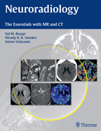Neuroradiology The Essentials with MR and CT