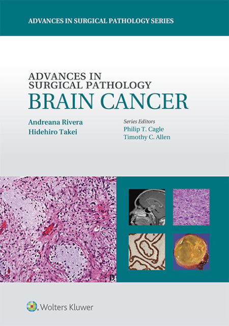 Advances in Surgical Pathology: Brain Cancer 2015