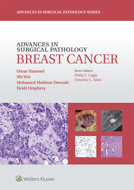 Advances in Surgical Pathology: Breast Cancer 2015