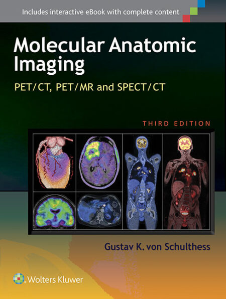 Molecular Anatomic Imaging: PET/CT, PET/MR and SPECT CT 3/E 2015