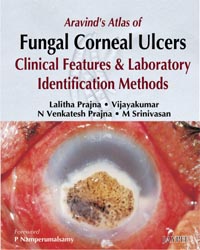 Aravind's Atlas of Fungal Corneal Ulcers: Clinical Features & Laboratory Identification Methods