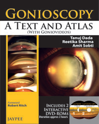 Gonioscopy: A Text and Atlas (with Goniovideos)