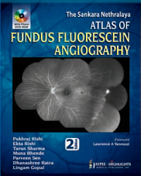 The Sankara Nethralaya: Atlas of Fundus Fluorescein Angiography
