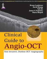 Clinical Guide to Angio-OCT (Non Invasive, Dyeless OCT Angiography)