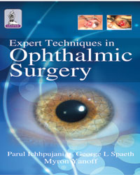 Expert Techniques in Ophthalmic Surgery