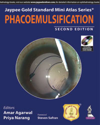 Jaypee Gold Standard Mini Atlas Series: Phacoemulsification (with DVD)