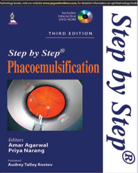 Step by Step Phacoemulsification (with DVD-ROM)
