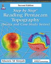 Step by Step Reading Pentacam Topography (Basics and Case Study Series)
