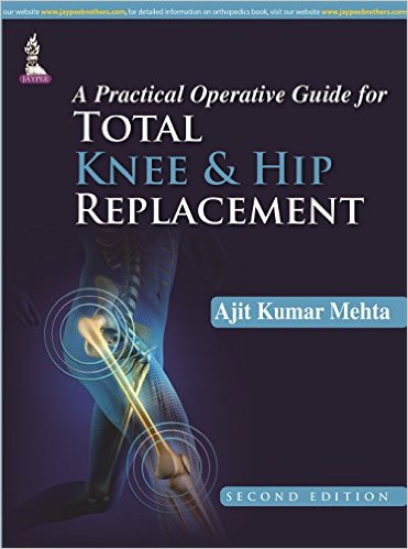 A Practical Operative Guide for Total Knee and Hip Replacement 2nd Edition