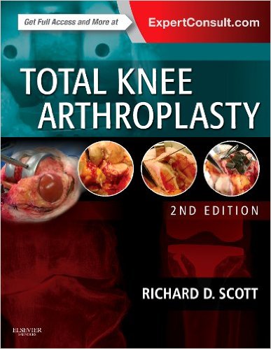 Total Knee Arthroplasty, 2e 2nd Edition