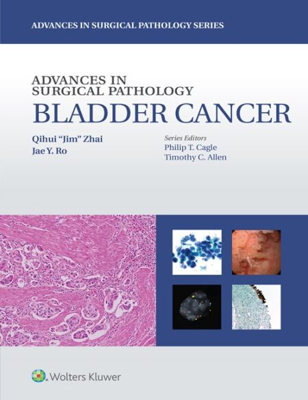 Advances in Surgical Pathology: Bladder Cancer 2016