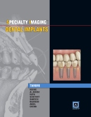 Specialty Imaging: Dental Implants 2014