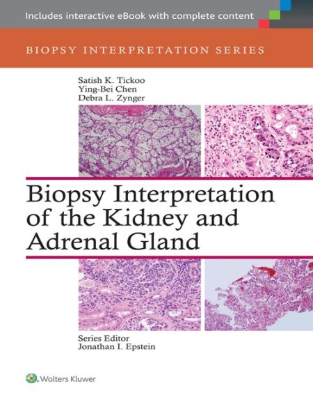 Biopsy Interpretation of the Kidney & Adrenal Gland 2016