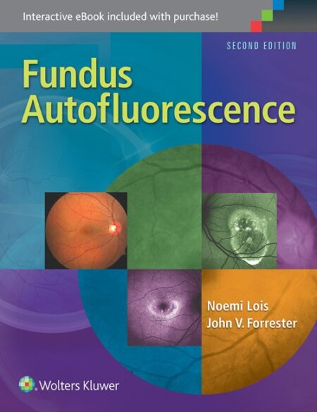 Fundus Autofluorescence 2/E 2016