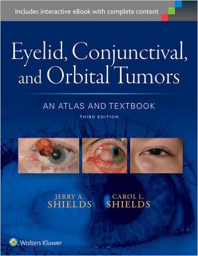 Eyelid, Conjunctival, and Orbital Tumors: An Atlas and Textbook 3/E