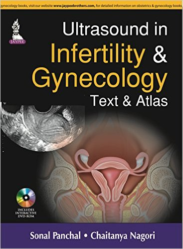 Ultrasound in Infertility and Gynecology