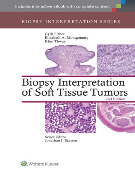 Biopsy Interpretation of Soft Tissue Tumors 2/E 2016