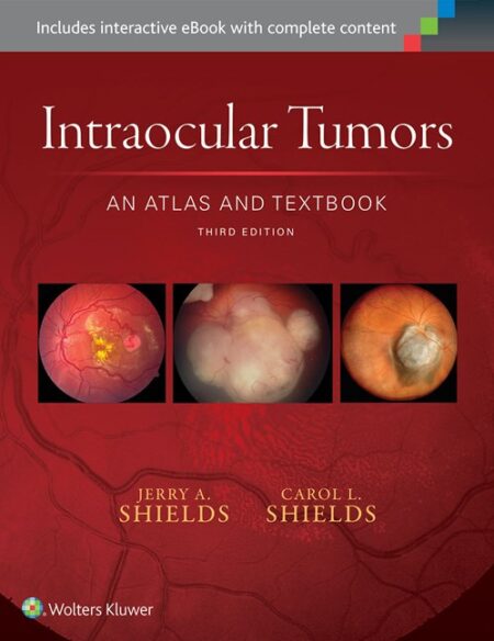 Intraocular Tumors: An Atlas and Textbook 3/E  2016