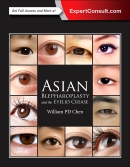 Asian Blepharoplasty and the Eyelid Crease, 3rd Edition 2016(已絕版)