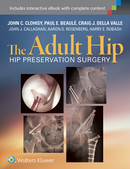 The Adult Hip (Two Volume Set): Hip Arthroplasty Surgery 3/E 2016