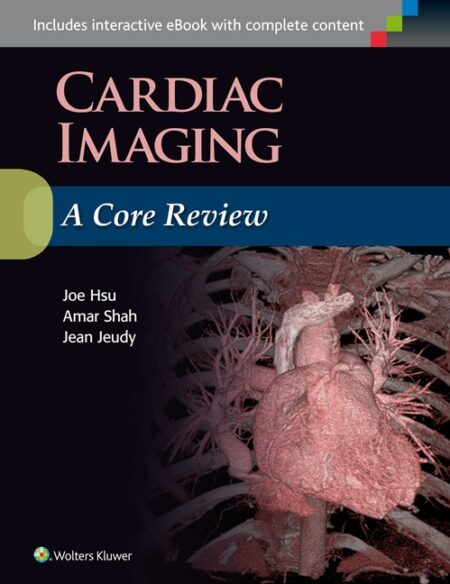 Cardiac Imaging: A Core Review 2016