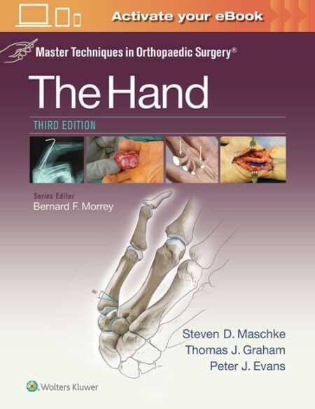 Master Techniques in Orthopaedic Surgery: The Hand  3/E  2016
