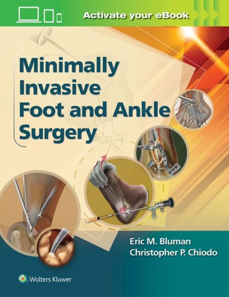 Minimally Invasive Foot & Ankle Surgery 2016