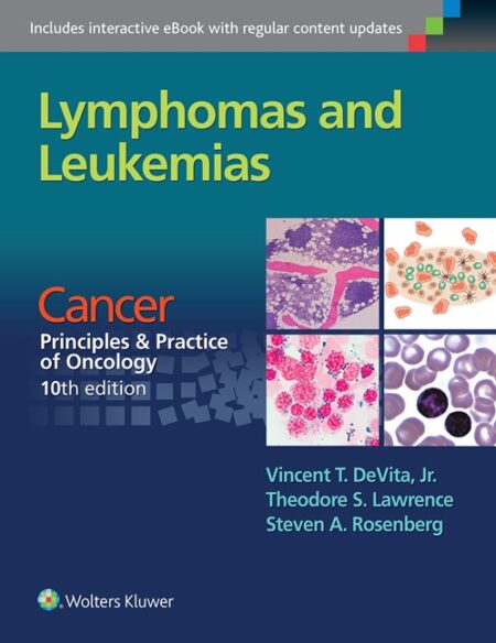 Lymphomas and Leukemias 2016