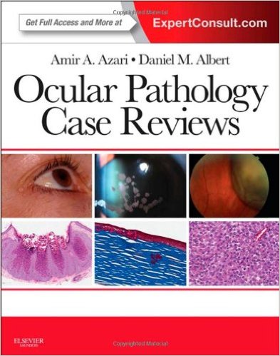 Ocular Pathology Case Reviews: Expert Consult - Online and Print