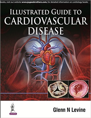 Illustrated Guide to Cardiovascular Disease