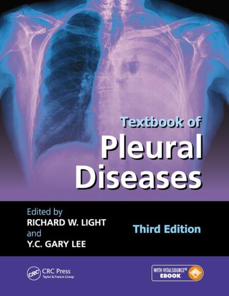 Textbook of Pleural Diseases, Third Edition 2016