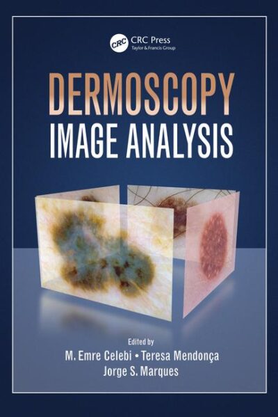 Dermoscopy Image Analysis 2016