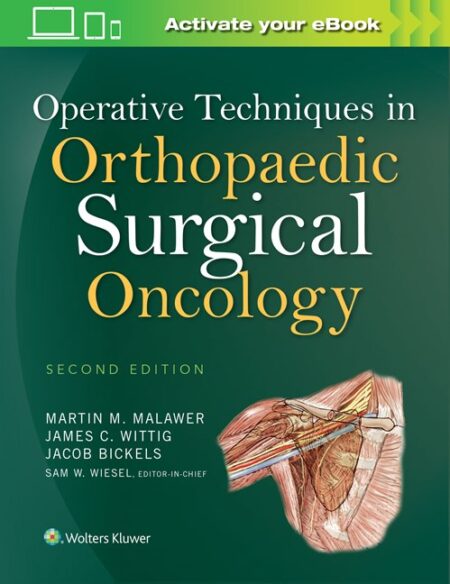 Operative Techniques in Orthopaedic Surgical Oncology Second Edition 2016