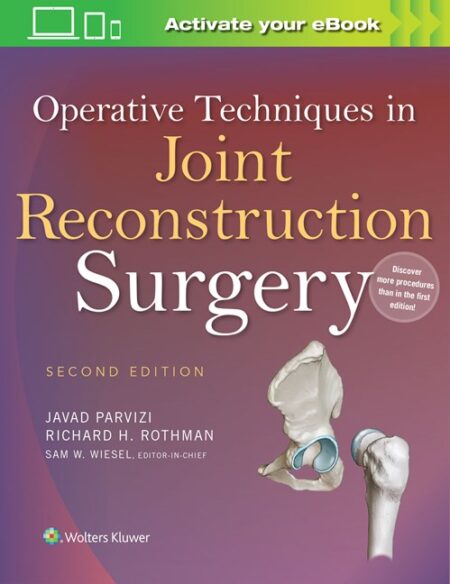 Operative Techniques in Joint Reconstruction Surgery Second Edition 2016