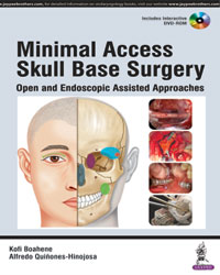 Minimal Access Skull Base Surgery: Open and Endoscopic Assisted Approaches (Includes Interactive DVD-ROM)