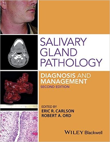 Salivary Gland Pathology: Diagnosis and Management 2nd Edition