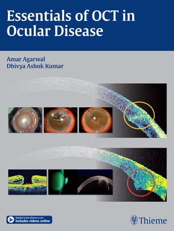 Essentials of OCT in Ocular Disease 2015