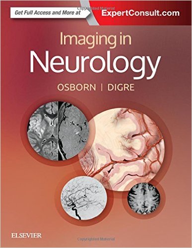 Imaging in Neurology + Ebook