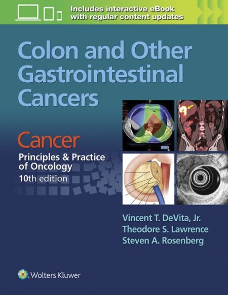 Colon and Other Gastrointestinal Cancers 2016