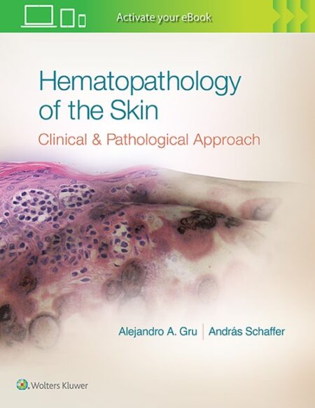 Hematopathology of the Skin: A Clinical and Pathologic Approach 2016
