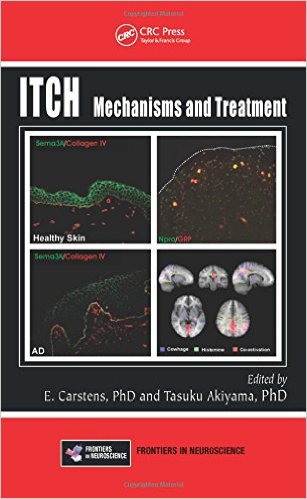 Itch: Mechanisms and Treatment