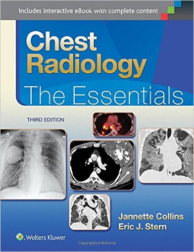 Chest Radiology: The Essentials 3/E + Ebook